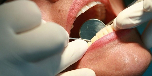 Mala higiene bucal puede provocar Alzheimer