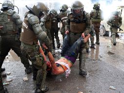 Además de la atención a heridos, se debe priorizar el manejo de la basura que se genera en las protestas y tratar a personas con algún problema de salud mental. AP/E. Félix