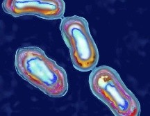 La peste está causada por la bacteria Yersinia pestis. GETTY IMAGES