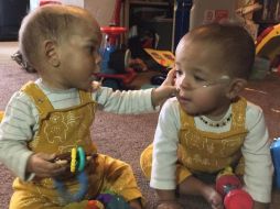 Deiniol (derecha) ya está en casa, pero todavía necesita oxígeno.