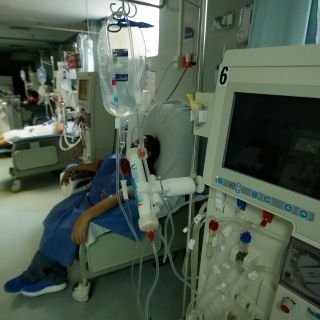 Crean un riñón artificial para mejorar la diálisis