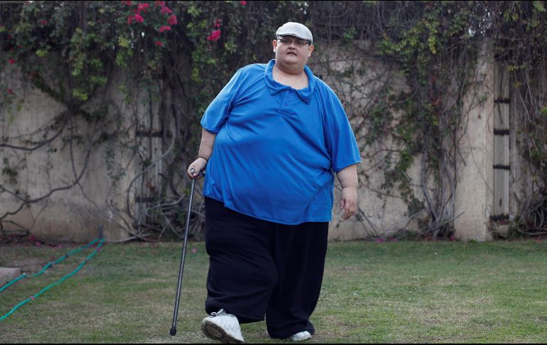 Especialistas creen que luego de la cirugía reconstructiva podrán quitar entre 70 y 80 kilos y con ello, Juan Pedro podrá acercarse a la meta de 150 kilos. EFE / F. Guasco