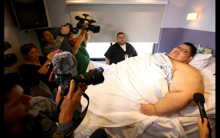 El 17 de mayo de 2017, con un peso de 420 kilos. Tras la operación, su estómago fue reducido para que quedara con la capacidad equivalente de un vaso de agua, en vez de los cinco litros que tenía antes. EFE/ARCHIVO