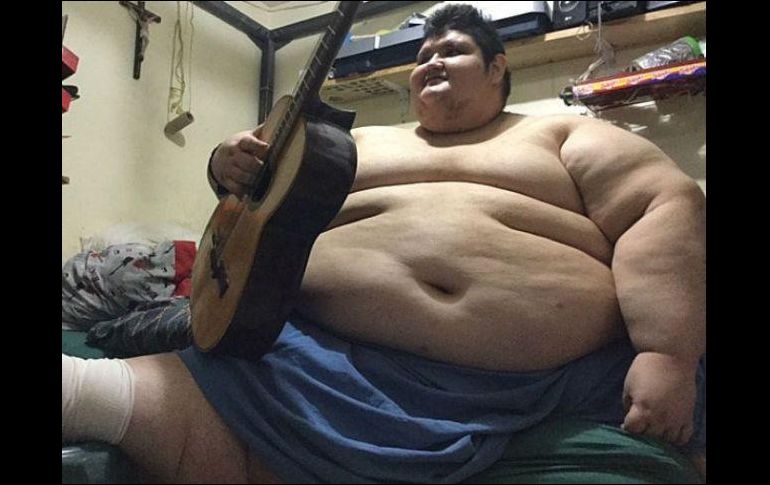 En 2016, Juan Pedro no podía levantarse de la cama en su casa de Aguascalientes. EFE/ARCHIVO