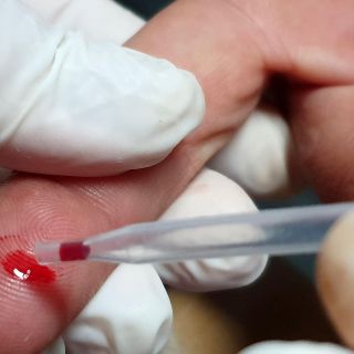 El IMSS registra hasta tres mil casos de VIH al año