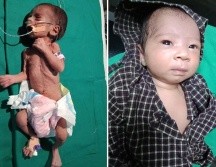 La bebé fue llevada al hospital en estado crítico, pero ahora está saludable. Dr Ravi Khanna