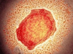 La viruela de los monos, también llamada viruela del simio o símica, es causada por un virus similar al de la viruela humana. SCIENCE PHOTO LIBRARY