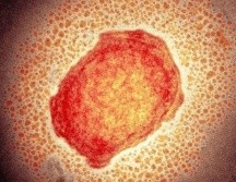 La viruela de los monos, también llamada viruela del simio o símica, es causada por un virus similar al de la viruela humana. SCIENCE PHOTO LIBRARY