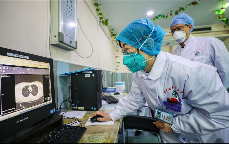 Personal médico observa una imagen del pulmón de un paciente en un hospital en Wuhan, China. AFP/ARCHIVO