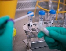 Una prueba de laboratorio confirma o descarta la presencia del coronavirus. AFP/DPA/ARCHIVO