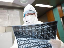 La Televisión Central de China (CCTV) reporta que además de este bebé, hay otro contagiado con el (2019-nCoV). EFE / EPA / YFC China Out