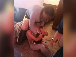 La joven presentaba hematomas, golpes, escoriaciones y crisis nerviosa. ESPECIAL