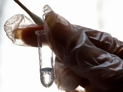 Recuerdan que no se necesitan pruebas de coronavirus para atender a los pacientes, porque no es una prueba de uso clínico. AP / A. Shirband