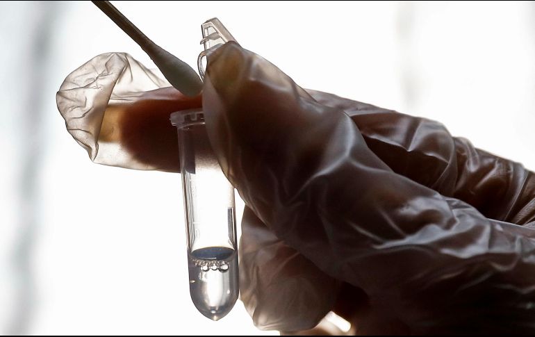 Recuerdan que no se necesitan pruebas de coronavirus para atender a los pacientes, porque no es una prueba de uso clínico. AP / A. Shirband