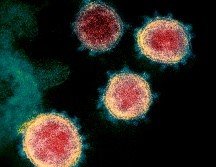 ''No queremos que esto sea el inicio de una dispersión importante de coronavirus'', dijo el secretario de Salud Jalisco, Fernando Petersen. AFP