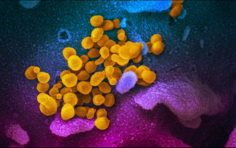 Imagen microscópica del SARS-CoV-2 (amarillo). El coronavirus es detectable en el aire hasta tres horas. EFE/NIH/ARCHIVO