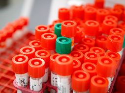 18 pruebas se encuentran en proceso en el laboratorio estatal de salud pública en espera de confirmar o rechazar más casos positivos. AP / J. Minchillo