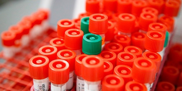 Aumentan a 12 los casos de COVID-19 en Puebla; 17 por confirmar