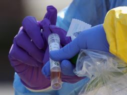 Al día de hoy, Edomex tiene 51 casos sospechosos y 123 pruebas realizadas se han reportado negativas a la enfermedad del coronavirus. AFP / B.  Bennett