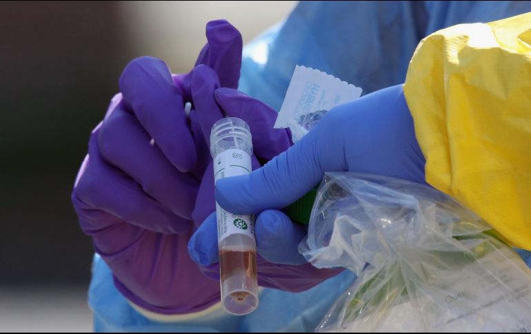Al día de hoy, Edomex tiene 51 casos sospechosos y 123 pruebas realizadas se han reportado negativas a la enfermedad del coronavirus. AFP / B.  Bennett