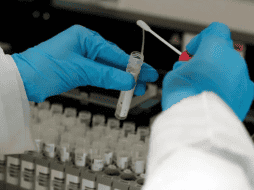 La Cepheid subraya que 