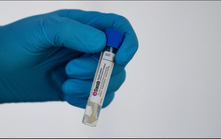 Los científicos también trabajan en medicamentos para tratar la sintomatología del coronavirus. AFP / F. Fife