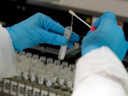 Se informó que el cuadro sintomático del fallecido se complicó debido a padecimientos asociados como la diabetes. AP / ARCHIVO