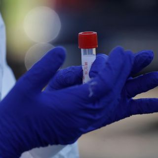 Pruebas rápidas, falibles y con aval provisional de la FDA