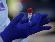 La autorización de las pruebas Xpert Xpress SARS-CoV-2, permite que sean utilizadas en una emergencia, cuando no existan alternativas adecuadas, aprobadas y disponibles. AP / A. Tarantino