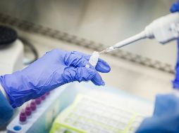 Adriana es diagnosticada con coronavirus el 14 de marzo, en el Instituto Nacional de Enfermedades Respiratorias (INER). AP / ARCHIVO