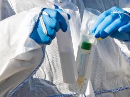 Al momento suman 29 casos confirmados de la enfermedad en Sonora. AP / J. Meyer