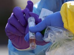 En caso de poder comprar las pruebas rápidas serán de la marca Xpert Xpress, detalla el gobernador de Jalisco.  AFP / B. Bennett