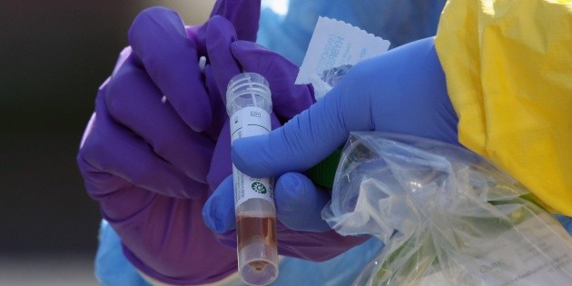 Gobierno de Jalisco asegura &ldquo;plan B&rdquo; para hacer pruebas masivas de COVID-19