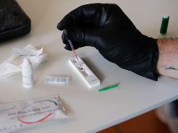Las pruebas de la Unidad de Patología Clínica tienen la misma validez que las que se realizan en el Laboratorio Estatal de la Secretaría de Salud Jalisco y el Hospital Civil Dr. Juan I. Menchaca. EFE/T. Petinga