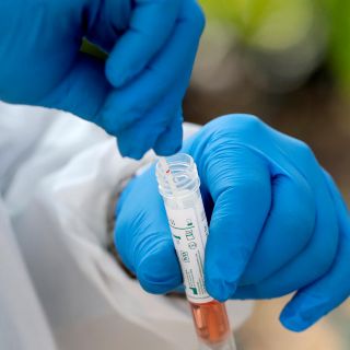 Llaman a no caer en venta de falsas pruebas rápidas de detección de COVID-19