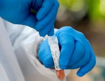 Resaltan que las únicas pruebas autorizadas para detectar el coronavirus son las tipo PCR. AP / L. Sladky