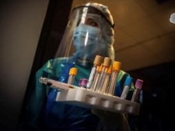 El test indica la presencia de anticuerpos contra el COVID-19, lo que significa que hubo exposición al patógeno, aunque sin poder definir si la infección sigue activa. EFE/P. Santamaría