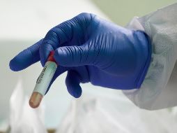 Ghana cuenta con el mayor número de infectados de COVID-19 de África occidental.  AP/ARCHIVO