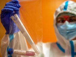 Investigadores y autoridades internacionales luchan para determinar qué vacunas funcionan realmente. AFP / K. Arvai