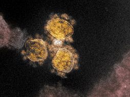 De todas las secuencias genéticas disponibles, el nuevo coronavirus tiene un origen natural, dijo la jefa del Departamento de Enfermedades Emergentes de la OMS, María Van Kerkhove. EFE/NIH/ARCHIVO