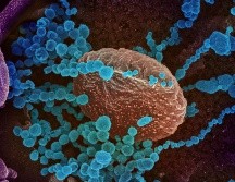 Aún se requiere mayor investigación para determinar si el SARS-CoV-2 puede transmitirse por vía sexual. EFE//NIAID- RML/NIH/ARCHIVO