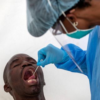 COVID-19 podría matar a 190 mil personas en África, dice OMS