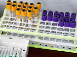 Manuel de la O Cavazos externó su preocupación por el crecimiento en la cifra de contagios y defunciones en la entidad. EFE/J. Jácome