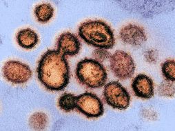 Las pruebas permitirán tener una idea de cuál fue el comportamiento nacional del coronavirus en México en esta primera ola. EFE/NIH/ARCHIVO