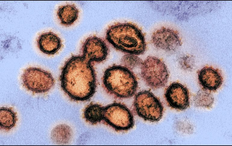 Las pruebas permitirán tener una idea de cuál fue el comportamiento nacional del coronavirus en México en esta primera ola. EFE/NIH/ARCHIVO