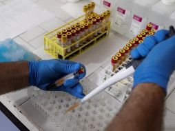 Senadores de PAN manifestaron su inconformidad ante el bajo número de test para detectar la enfermedad que se aplican en el país. EFE/E. Sahin