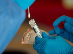 La prueba estará disponible en departamentos ambulatorios, en hospitales designados y centros de pruebas de PCR. AFP / ARCHIVO