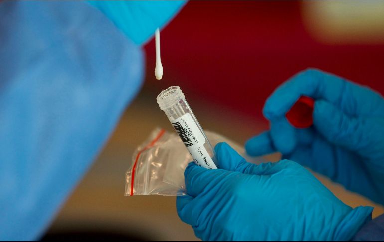 La prueba estará disponible en departamentos ambulatorios, en hospitales designados y centros de pruebas de PCR. AFP / ARCHIVO