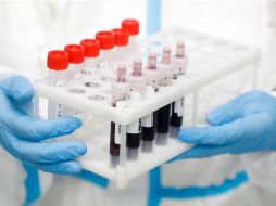 En América los casos suman 3.41 millones, mientras que en Europa se mantienen en torno a los 2.32 millones. EFE/M. Shipenkov