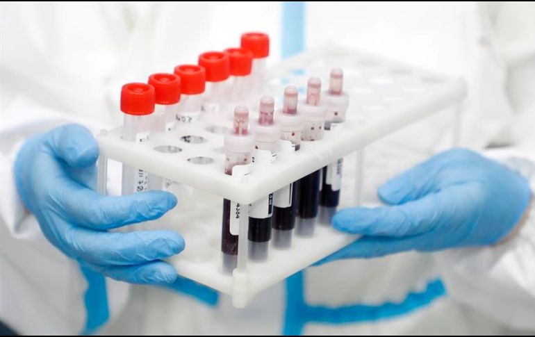 En América los casos suman 3.41 millones, mientras que en Europa se mantienen en torno a los 2.32 millones. EFE/M. Shipenkov